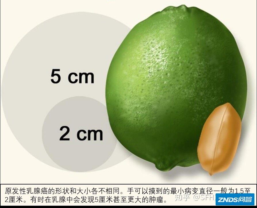 一文读懂乳腺癌的病理报告-5.jpg
